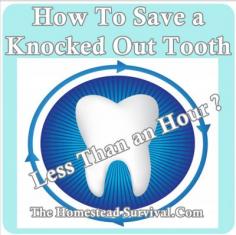 
                    
                        The Homestead Survival | How To Save a Knocked Out Tooth | Health - Homesteading - thehomesteadsurvi...
                    
                