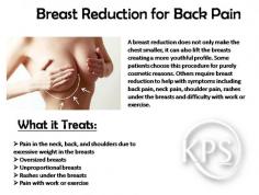 A breast reduction does not only make the chest smaller, it can also lift the breasts creating a more youthful profile. 