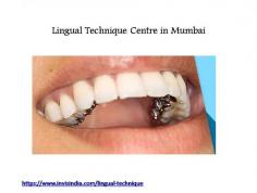 Lingual Technique Centre in Mumbai

Patients no longer need to be fearful or self- conscious about wearing braces. The first step in improving your smile is to furnish yourself with more information about the treatment options available to you and clear your doubts and misconceptions about braces with facts and not depend on hear says for your decisions.

For more info, please visit at https://www.invisindia.com/lingual-technique/